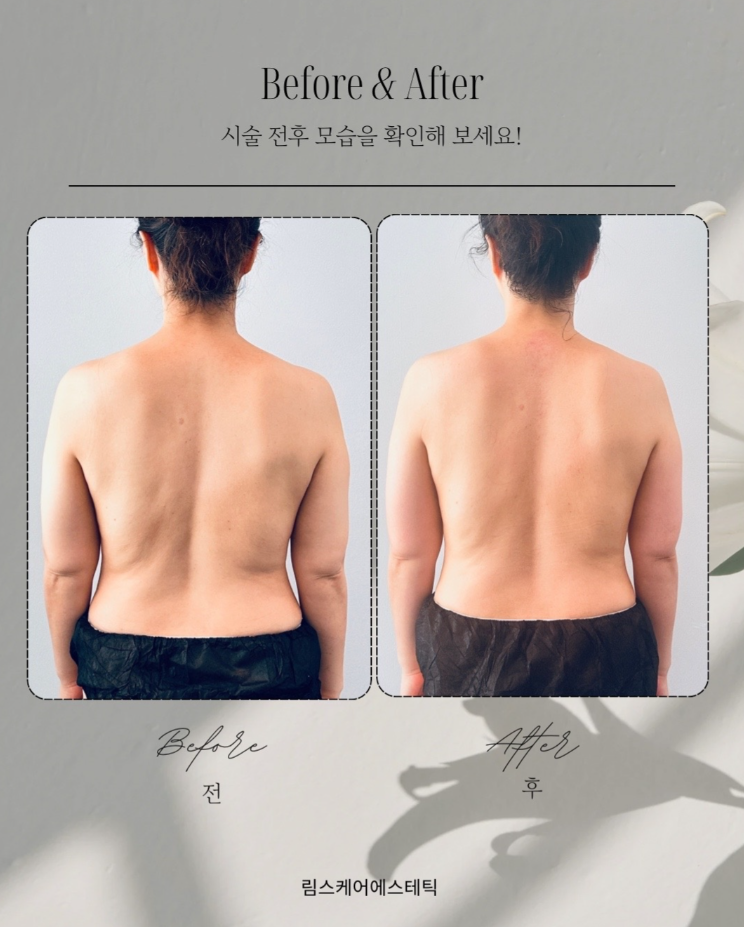 림스케어