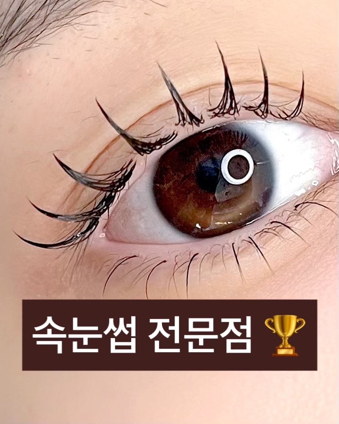 소이결