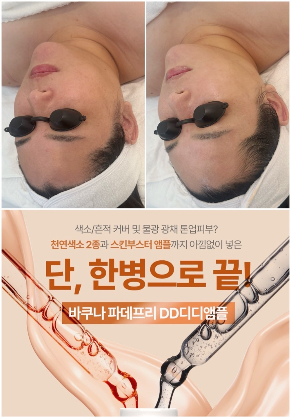 제이스오유 에스테틱 대구피부관리