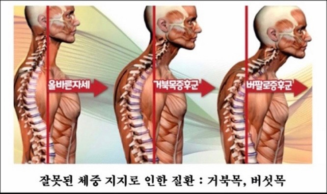 에그에스테틱