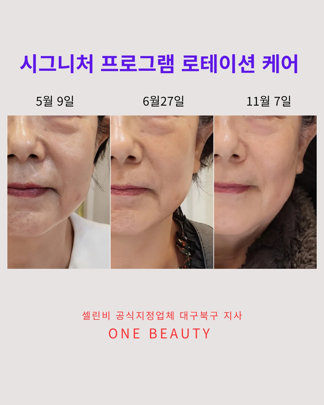 원뷰티